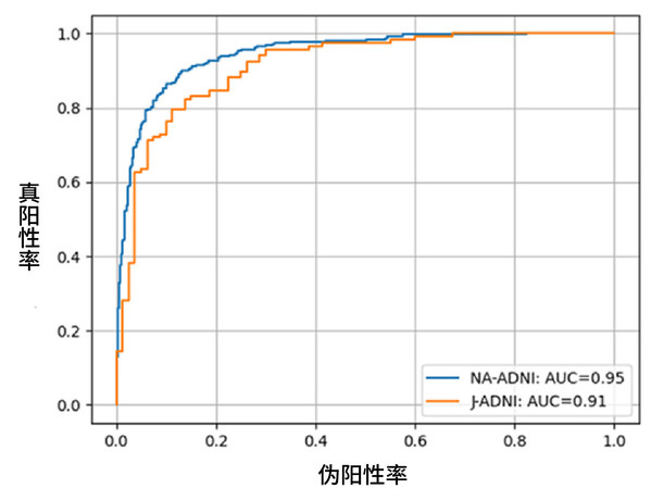 富士膠片AI技術(shù)可預(yù)測認(rèn)知癥是否會進(jìn)展為阿爾茨海默病