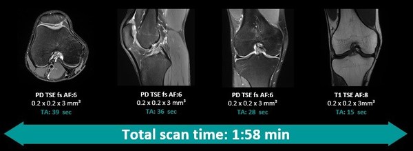 應(yīng)用Deep Resolve，超高分辨率完整膝關(guān)節(jié)掃描可在2分鐘以?xún)?nèi)完成，并提供高信噪比圖像